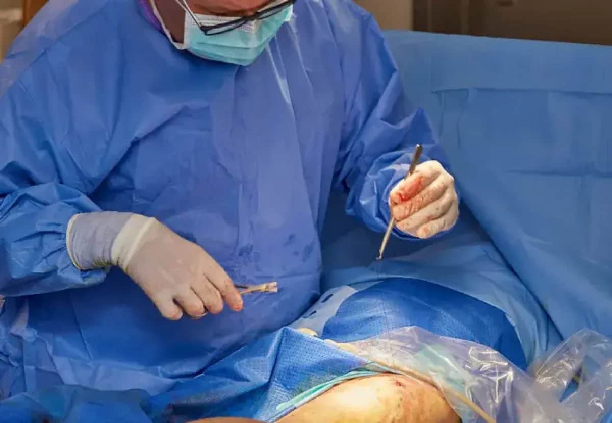 Żylaki: Flebolog, chirurg naczyniowy? Kto pomoże?