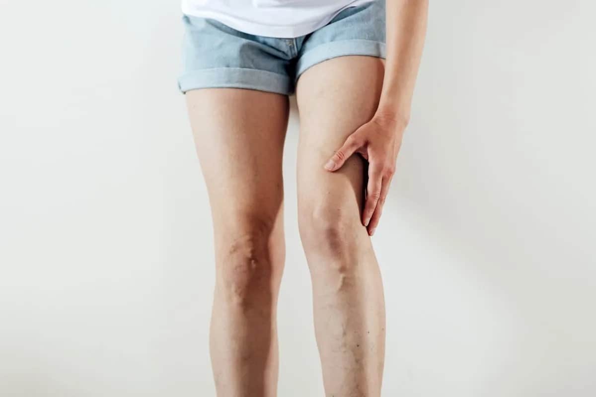 Zatrzymanie wody: leki, zioła, dieta. Kiedy do lekarza?