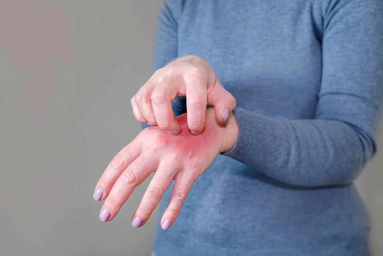 Uczulenie na hybrydę? Akryl nie jest ratunkiem! Dlaczego?