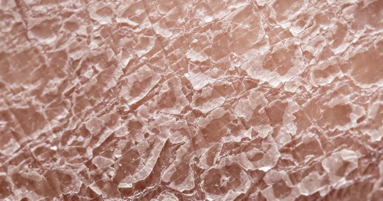 Metotreksat: Skutki uboczne? Poznaj prawdę i chroń swoje zdrowie